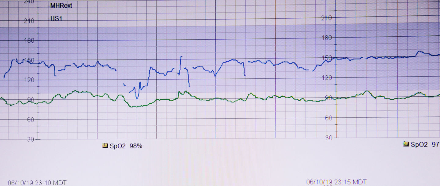 A screenshot of health informatics taken from a monitor
