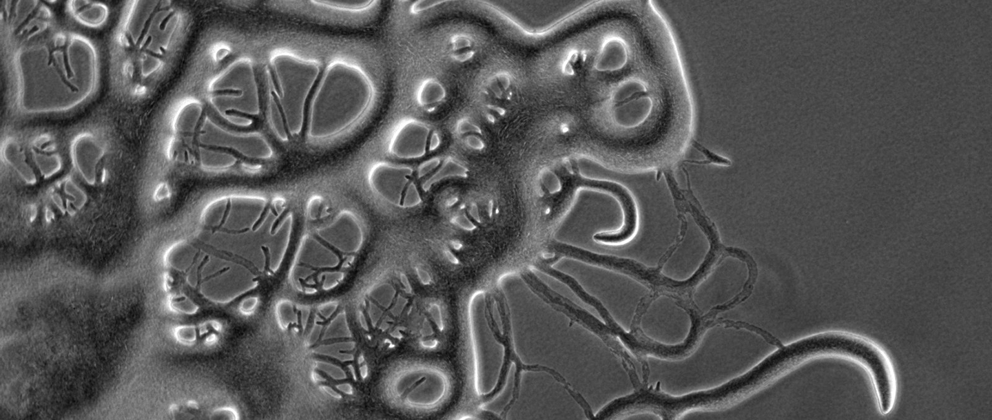 Microscopic view of Flavobacterium johnsoniae spreading
